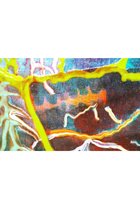thumbnail other-2